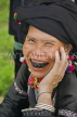 VIETNAM, Lao Cai province, Sapa, Tam Duong, Black Lu tribe woman, black teeth, VT635JPL